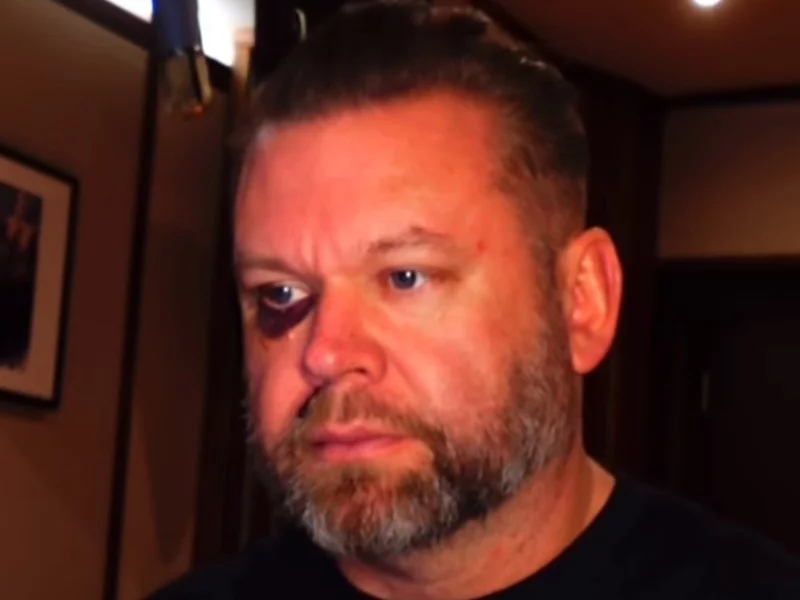 Marek Walaszek z podbitym okiem